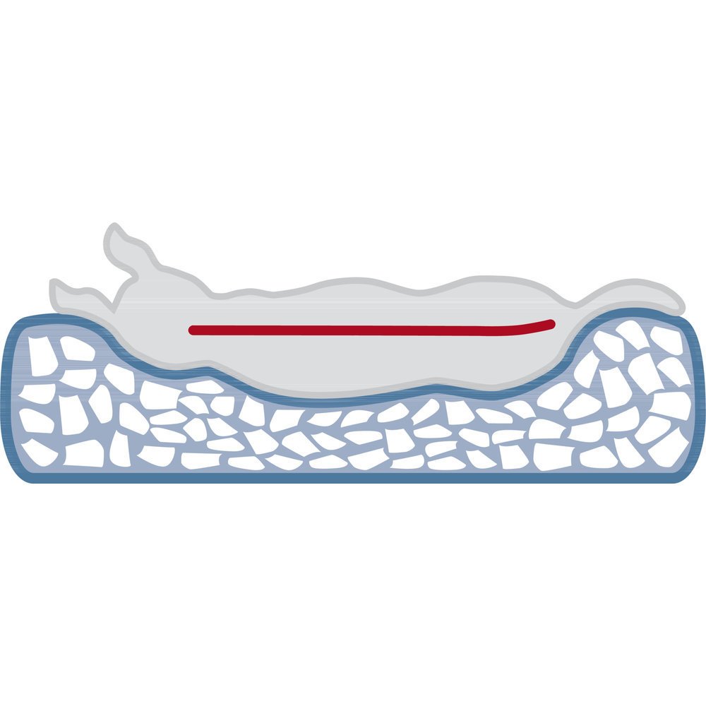 Trixie Vital orthopädisches Hundebett Pulito Bild 16